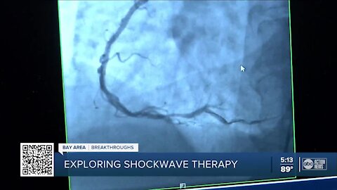 Largo Med first in Tampa Bay to offer breakthrough surgery for calcium buildup in coronary arteries