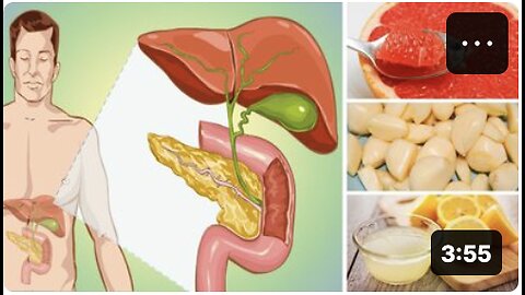 Eat These 7 Foods to Naturally Cleanse Your Liver!