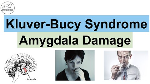 Kluver-Bucy Syndrome | Causes, Pathophysiology, Signs & Symptoms, Diagnosis, Treatment