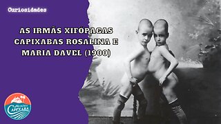 As irmãs xifópagas capixabas Rosalina e Maria Davel (1900)