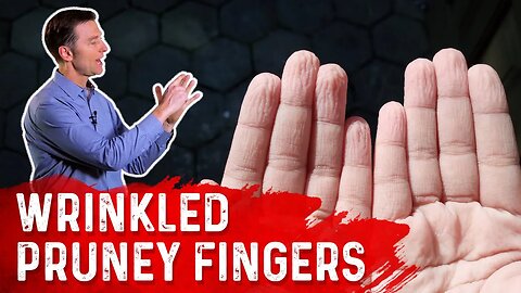 Wrinkled Pruney Fingers – Causes & Remedy – Dr. Berg