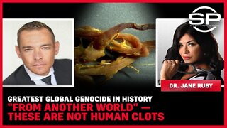 Greatest Global Genocide In History "From Another World" - These Are Not Human Clots