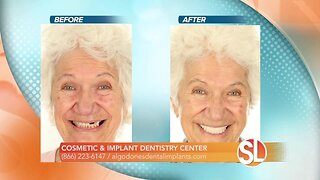 Cosmetic & Implant Dentistry Center offers dental implants at a lower price