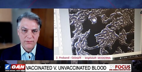 Microscopic News - Spike Protein in Blood of Vaccinated with Dr. Clinton Ohlers - OAN