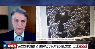 Microscopic News - Spike Protein in Blood of Vaccinated with Dr. Clinton Ohlers - OAN