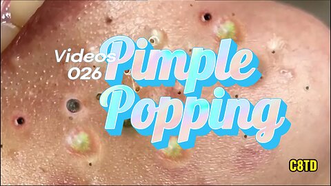 Satisfying Pimple Popping Videos 026