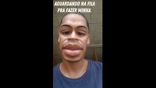 Aguardando na fila pra fazer minha cirurgia de harmonização facial