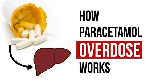 How Paracetamol Overdose Works