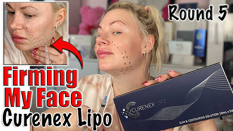 Firming my Face with Curenex Lipo, Round 5 from AceCosm.com | Code Jessica10 Saves you Money $$$