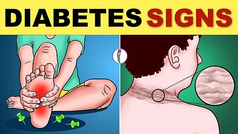 Diabetes Symptoms | Diabetes Mellitus | Type 2 Diabetes - Signs & Symptoms | Diabetes Warning Signs (check the description)