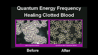 Quantum Biology & Frequency - Healing Clotted Blood & Much More - Try it for Free