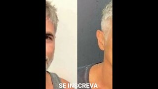 REYNALDO GIANECCHINI FAZ PROCEDIMENTO ESTÉTICO DE REJUVENESCIMENTO FACIL, VEJA O RESULTADO.