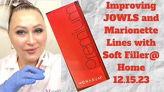 IMPROVING JOWLS AND MARIONETTE LINES WITH SOFT FILLER @ HOME. 12.15.23 #Fillers