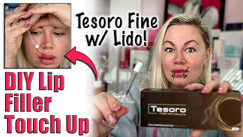 DIY Lip Filler Touch up with Tesoro Fine, AceCosm| Code Jessica10 saves you money
