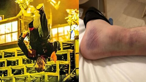 Slipknot’s Mike Pfaff Suffers Gnarly Ankle Injury, Will Still Perform