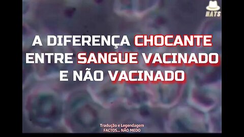 💉⚠️🤯💥A DIFERENÇA CHOCANTE ENTRE SANGUE VACINADO E NÃO VACINADO💉⚠️🤯💥