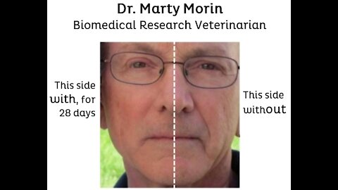 Martin Morin, DVM is an expert in Redox Signaling Molecules.