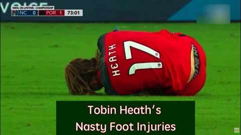 Tobin Heath's Nasty Foot Injuries #ncaawomensoccer #nwslinjuries #womensoccerhighlights Win $25 Gift