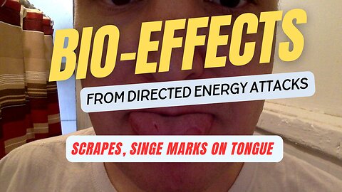 Bio-Effects Directed Energy Intermediate Force - Targeted Tongue