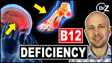 First Sign of a B12 Deficiency - Weird Symptoms!