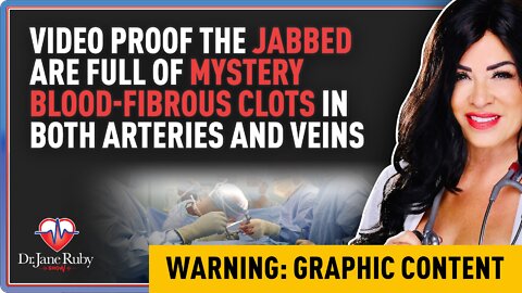 Worldwide Exclusive: Embalmers Find Veins & Arteries Filled with Never Before Seen Rubbery Clots