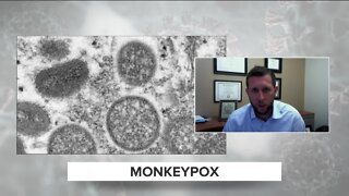 Monkeypox and COVID viruses