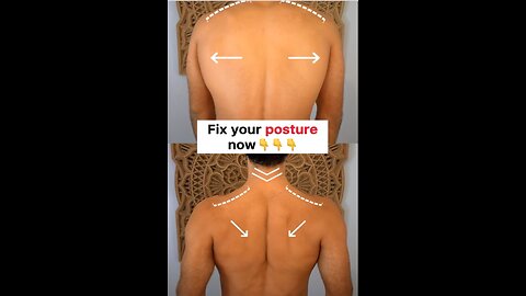 Posture Perfect: Strengthen and Correct with These Effective Exercises! 💪👩‍⚕️✨