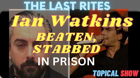 Ian Watkins, Lost Prophets Singer & Convicted Wrongun Beaten and Stabbed in Prison