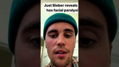 Justin bieber reveals he’s facial paralysis please make this go viral | #shorts | #viral | #trending