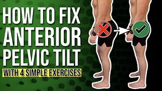 Anterior Pelvic Correction Exercises | The 4 BEST Ones You Can Do