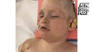 11-year-old Georgia boy mauled by pit bulls gives heartbreaking update from hospital