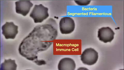 Bacteria vs. Macrophage: Unveiling the Battle Within Your Immune System