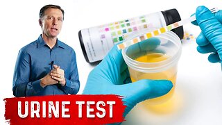 Urine Test Simplified