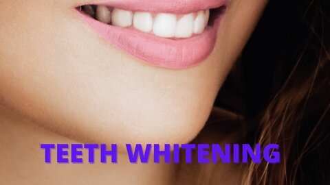 Natural Teeth Whitener: Teeth whitening: my best luma smile teeth whitening kit review: