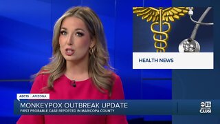 First probable case of monkeypox in Maricopa County