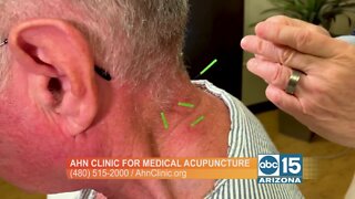 Got a pain in the neck? Doctor Yang Ahn treats chronic cervical pain using medical acupuncture