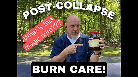 POST COLLAPSE BURN CARE! <5 mins