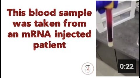 This blood sample was taken from an mRNA injected patient.