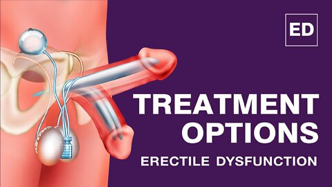 Erectile Dysfunction Treatments | How To Cure Erectile Dysfunction Permanently Without Side Effect