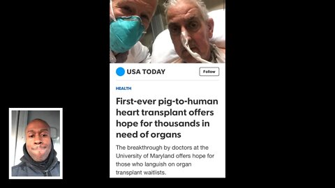 Man gets a pig heart (pig to human heart transplant)