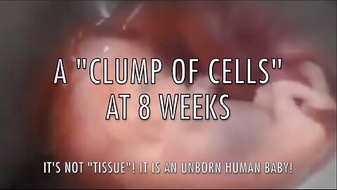 A "CLUMP OF CELLS" AT 8 WEEKS