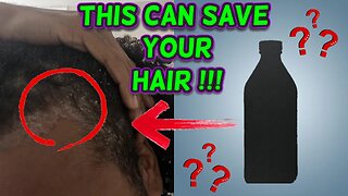 Having Scalp Problems? Watch This Video...