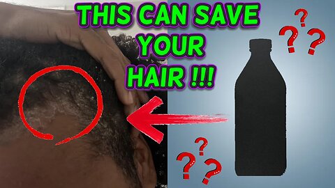 Having Scalp Problems? Watch This Video...