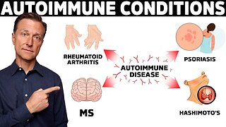 7 Surprising Causes of Autoimmune Diseases They Never Told You About