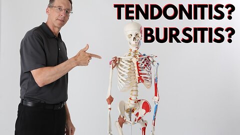 What is Causing Your Shoulder Pain -Tendonitis, Bursitis, How to Know