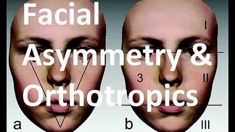 Causes, Treatment and Complications of Facial Asymmetry by Prof John Mew