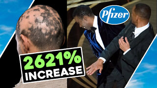 Pfizer SLAP Stunt HAIR LOSS 2621% ⬆ INCREASE / Hugo Talks