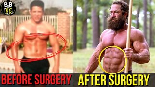 LiverKing Had THIS Ab Surgery