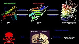 ALL Diseases Caused by Parasites, Prions, Funguses & Poisons?