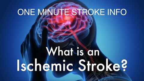 One Minute Stroke Info: What is an Ischemic Stroke